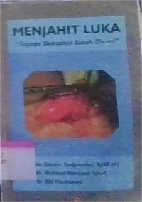 Image of Menjahit Luka Supaya Bekasnya Susah Dicari