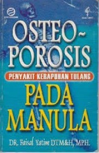 Image of Osteoporosis Penyakit Kerapuhan Pada Manula