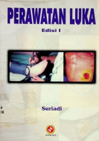Image of Perawatan Luka